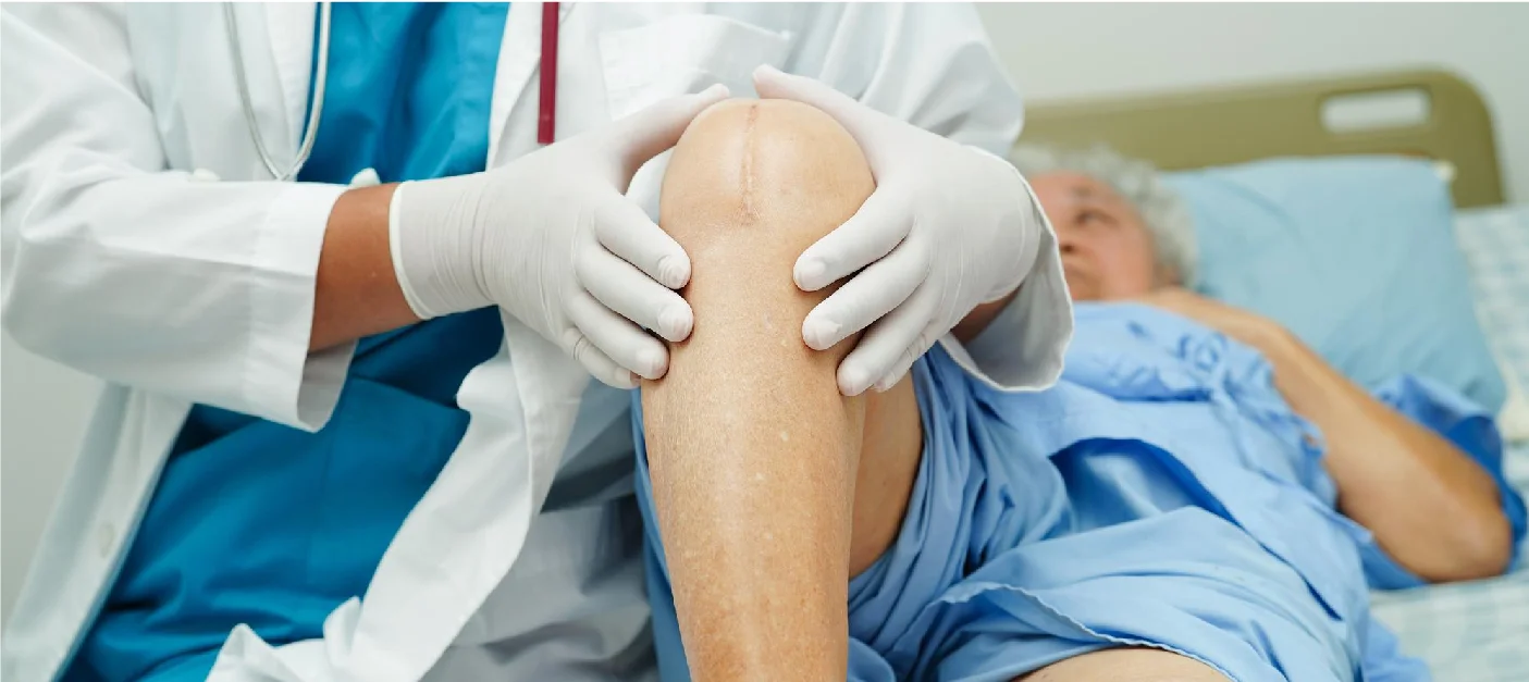 Joint Replacement Doctor