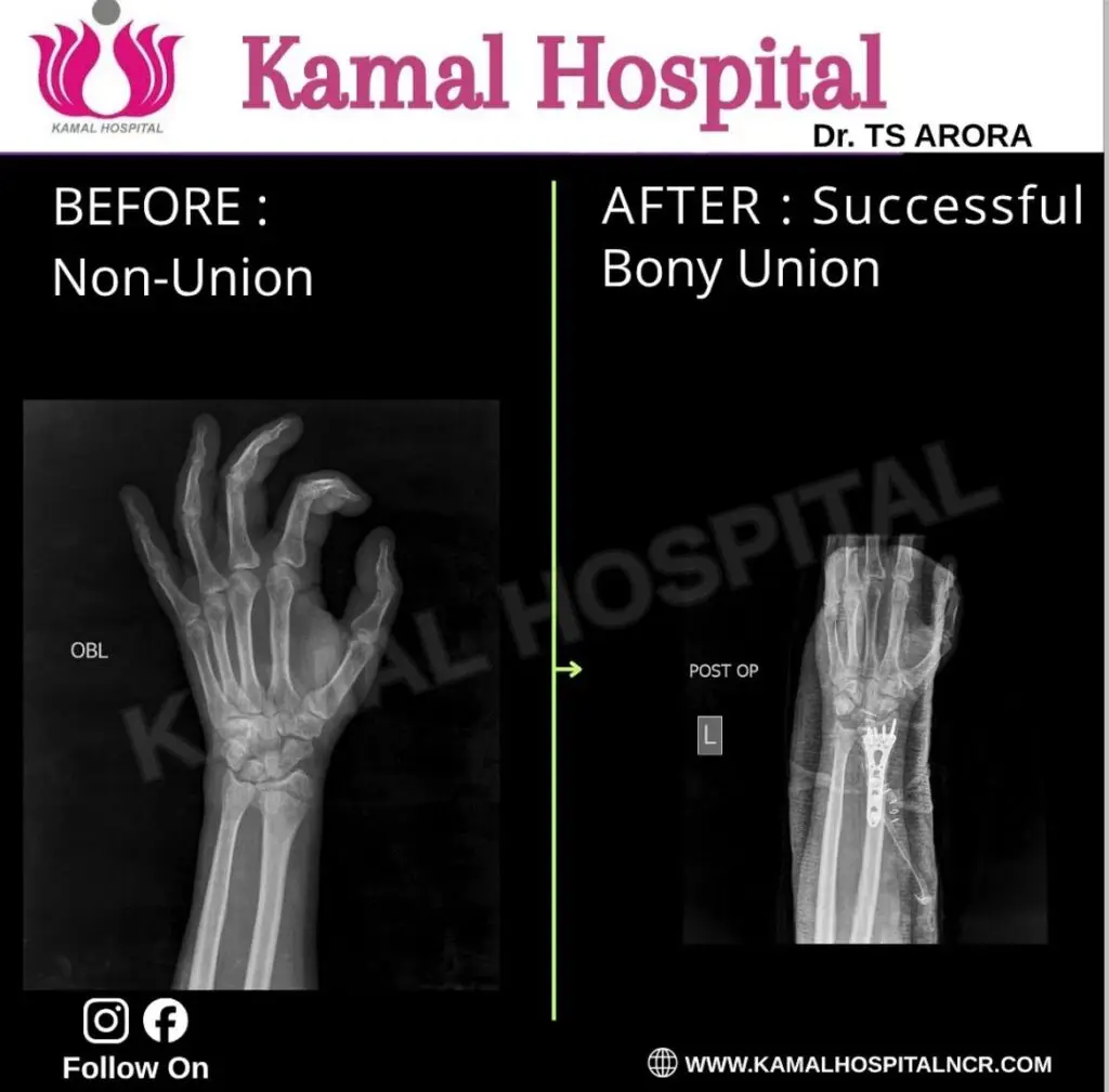 Orthopedic Hospital